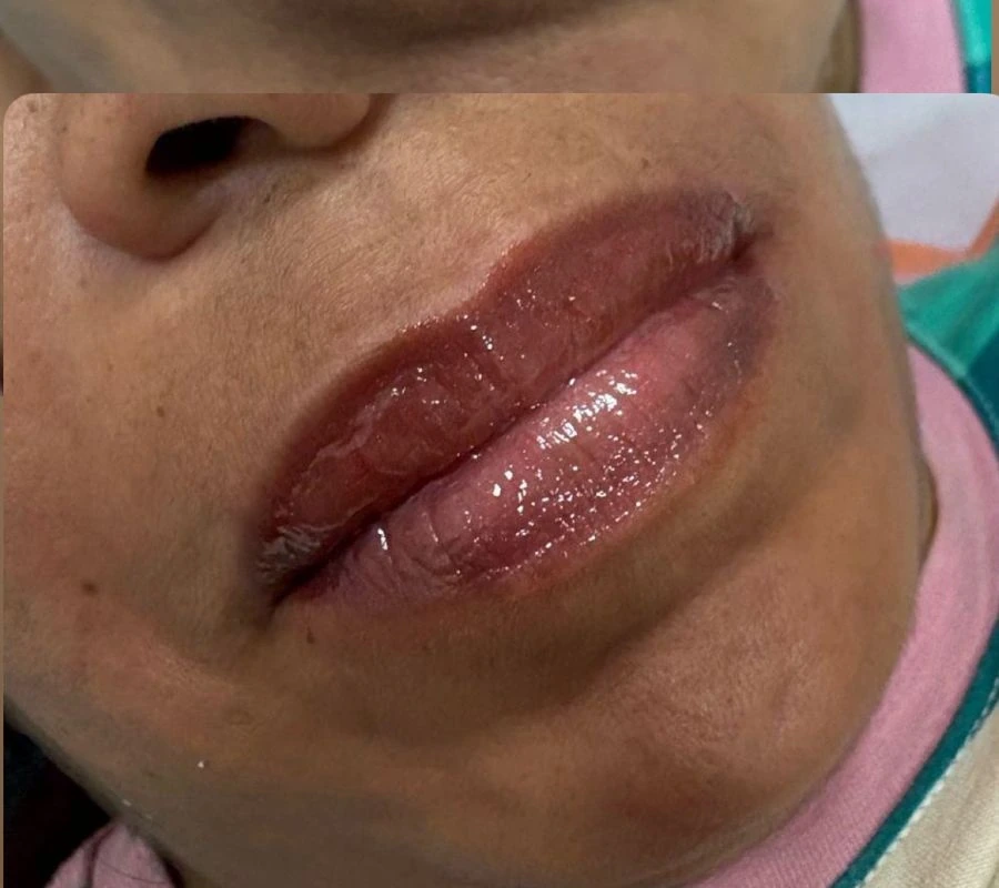 Lábios depois do cuidado HidraGloss