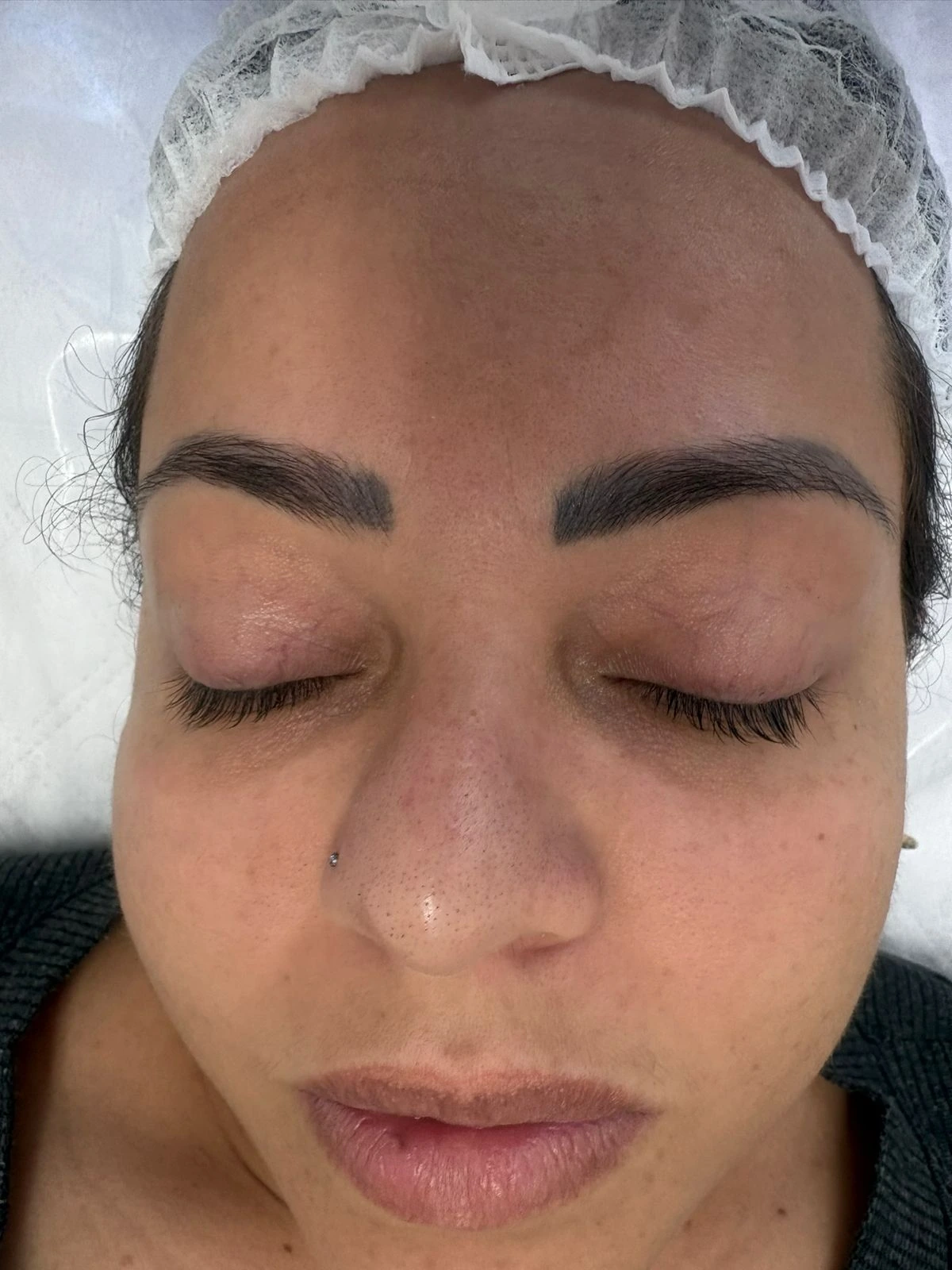 Registro facial antes da limpeza de pele