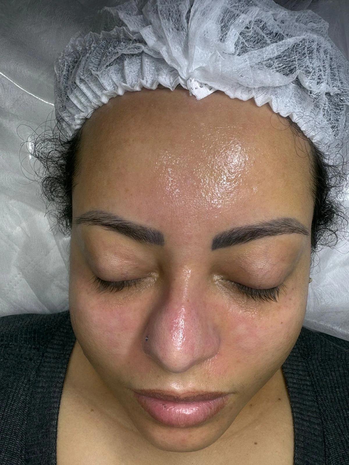Registro facial depois da limpeza de pele
